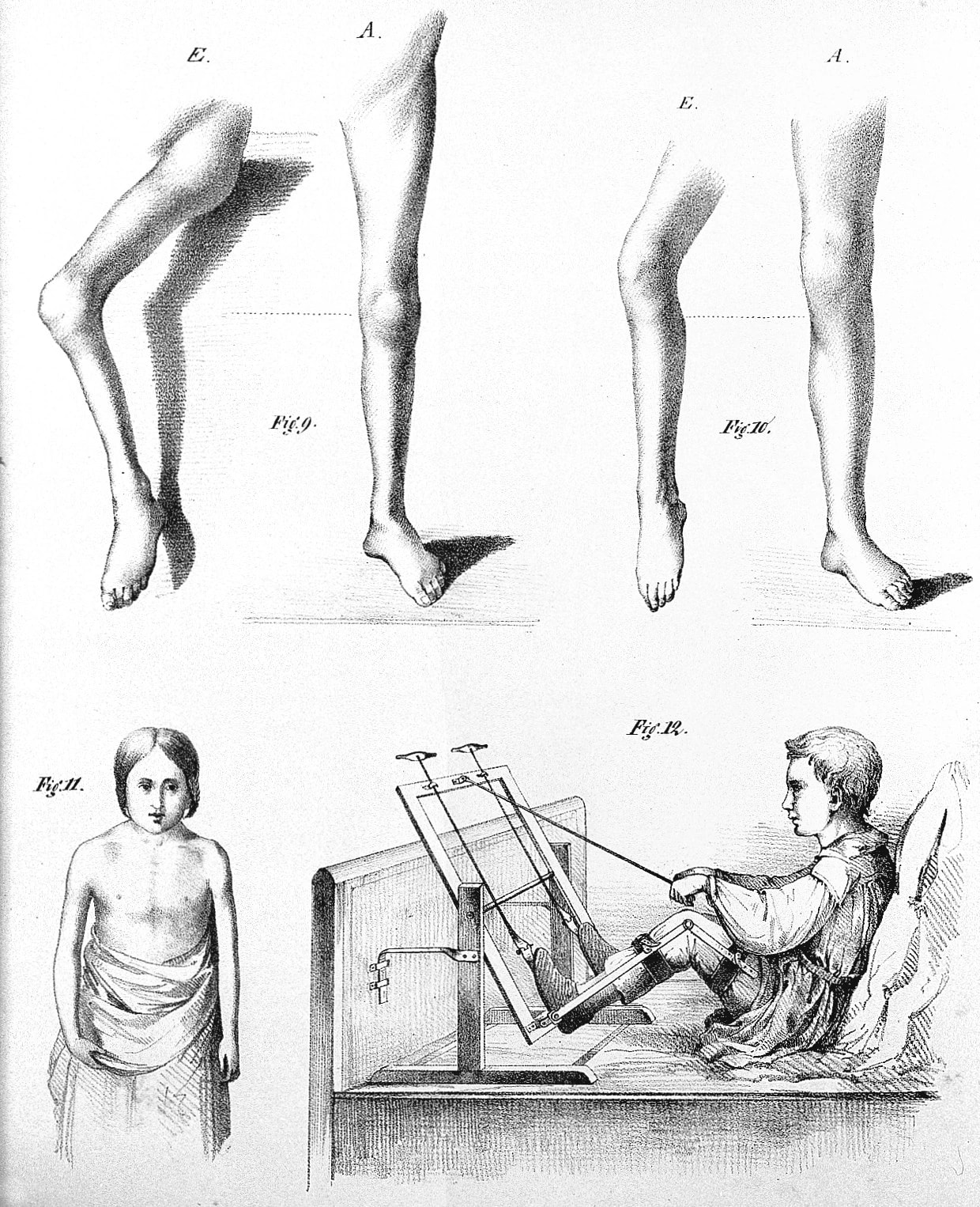 Historical illustration of British doctor Michael Underwood